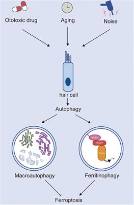 The role of autophagy and ferroptosis in sensorineural hearing loss